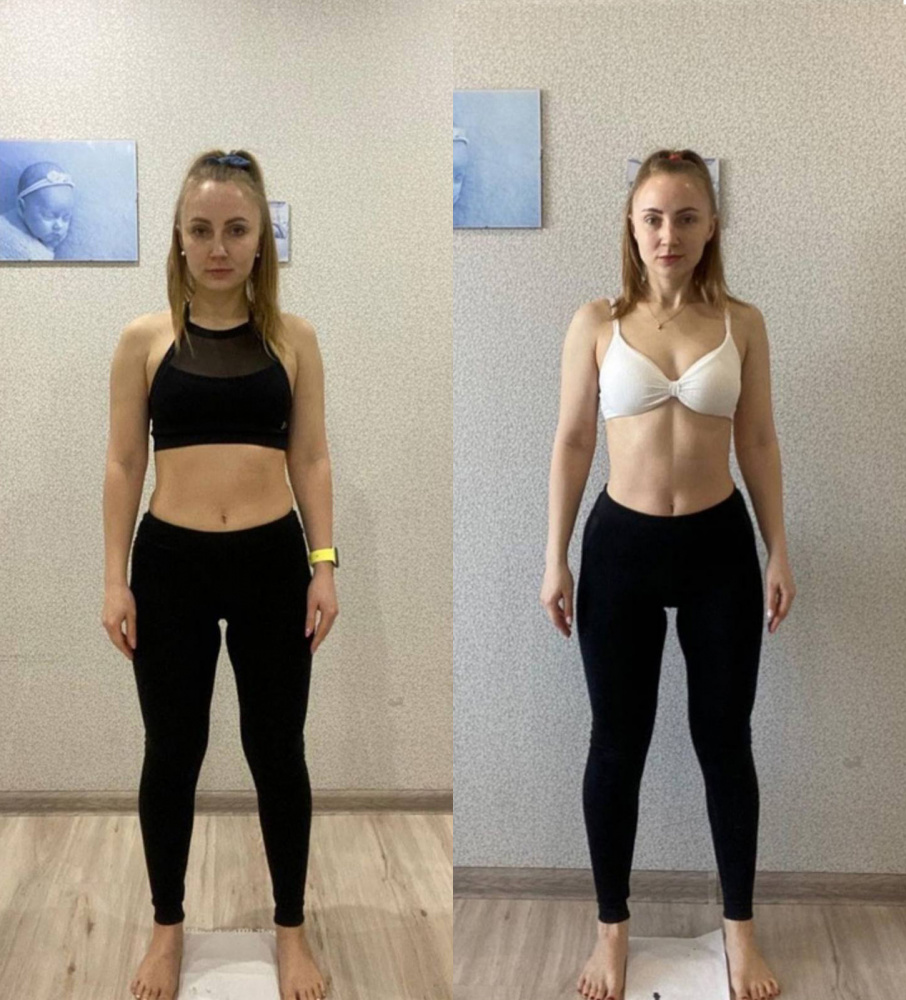 ЛИНЕЙКА - SUPER FIT 1000