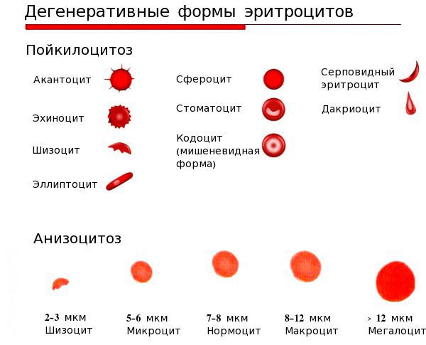 Дегенеративные формы эритроцитов